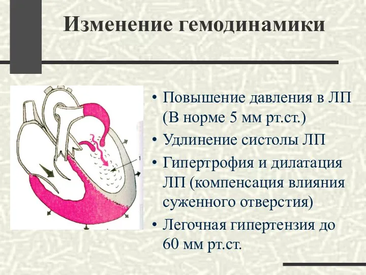 Изменение гемодинамики Повышение давления в ЛП (В норме 5 мм рт.ст.)