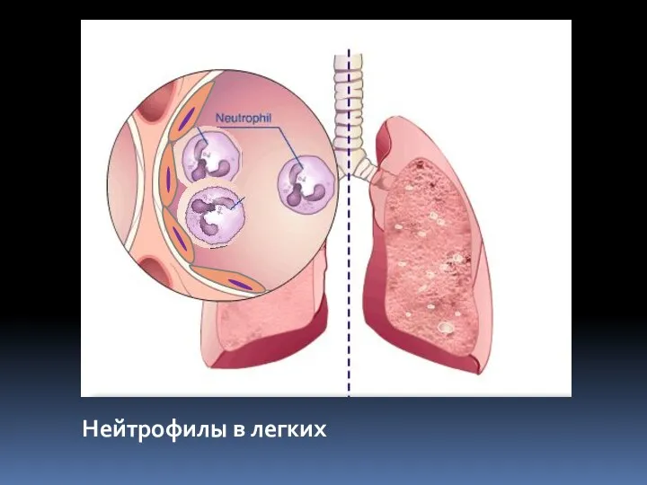 Нейтрофилы в легких