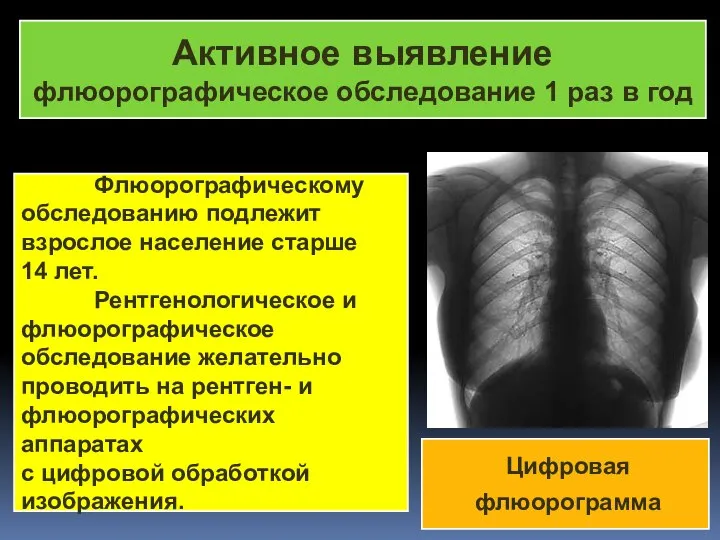 КФ Активное выявление флюорографическое обследование 1 раз в год Флюорографическому обследованию