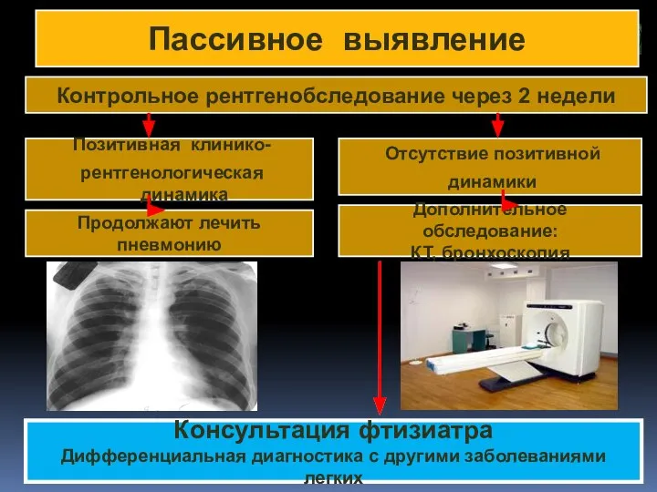 КФ Позитивная клинико- рентгенологическая динамика Дополнительное обследование: КТ, бронхоскопия Продолжают лечить