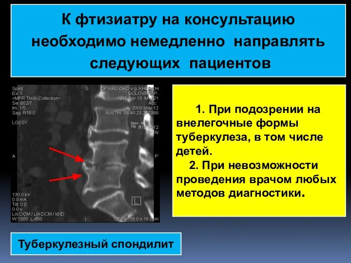 К фтизиатру на консультацию необходимо немедленно направлять следующих пациентов 1. При