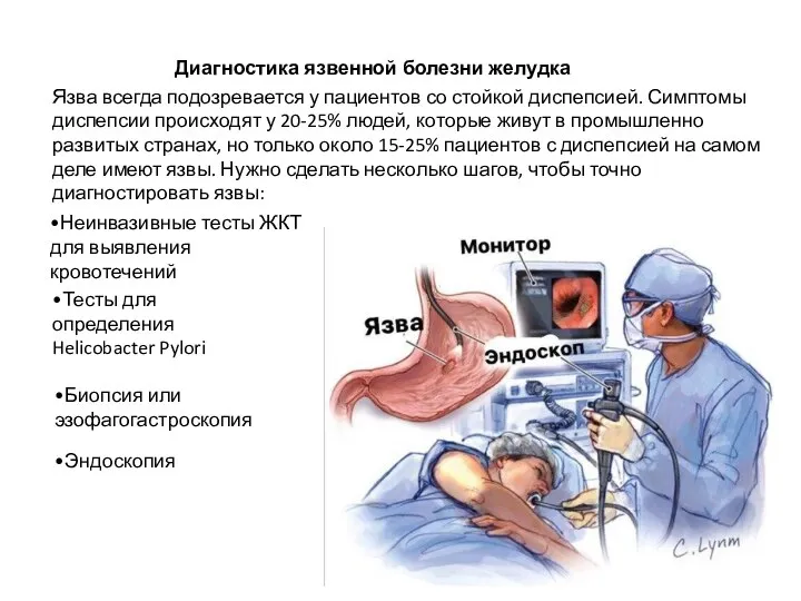 Диагностика язвенной болезни желудка Язва всегда подозревается у пациентов со стойкой