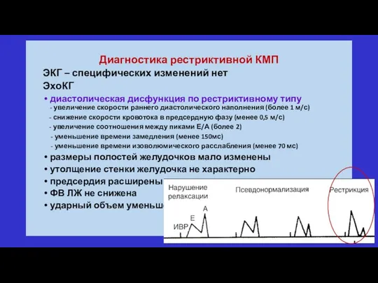 Диагностика рестриктивной КМП ЭКГ – специфических изменений нет ЭхоКГ диастолическая дисфункция