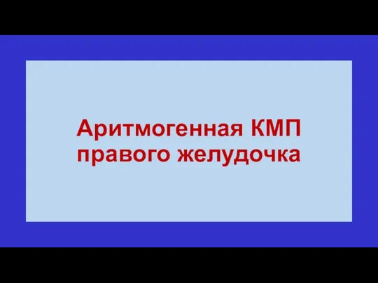 Аритмогенная КМП правого желудочка