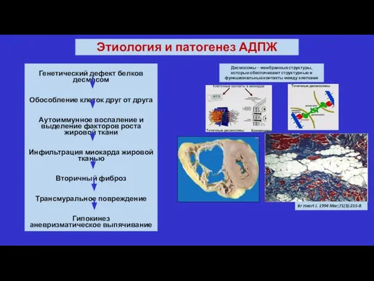 Генетический дефект белков десмосом Обособление клеток друг от друга Аутоиммунное воспаление