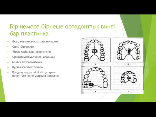 Бір немесе бірнеше ортодонттық винті бар пластинка Әсер ету механизмі:механикалық Орны:біржақтық