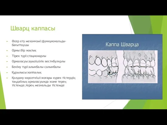 Шварц каппасы Әсер ету механизмі:функциональды-бағыттаушы Орны:бір жақтық Тірек түрі:стационарлы Орналасуы:ауызішілік вестибулярлы