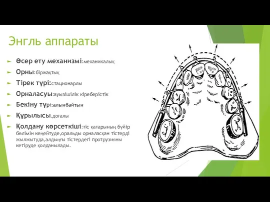 Энгль аппараты Әсер ету механизмі:механикалық Орны:біржақтық Тірек түрі:стационарлы Орналасуы:ауызішілік кіреберістік Бекіну