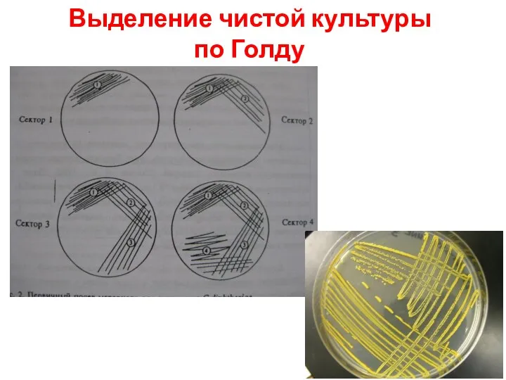 Выделение чистой культуры по Голду