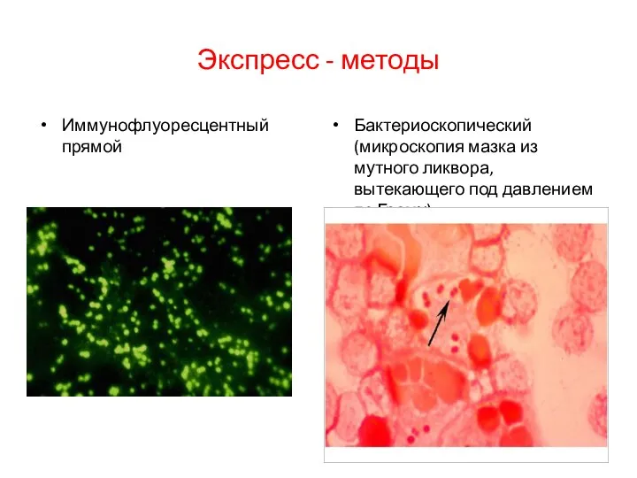 Экспресс - методы Иммунофлуоресцентный прямой Бактериоскопический (микроскопия мазка из мутного ликвора, вытекающего под давлением по Граму)