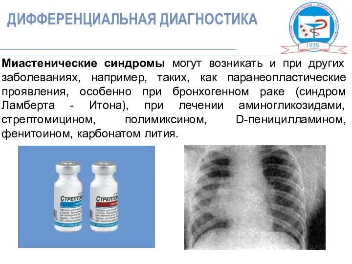 Миастенические синдромы могут возникать и при других заболеваниях, например, таких, как