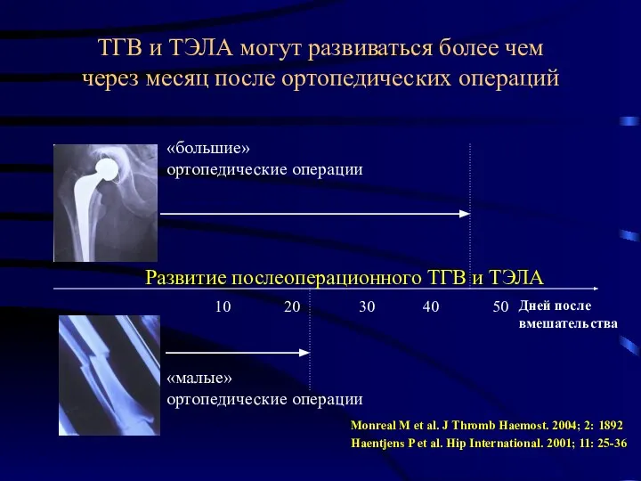 ТГВ и ТЭЛА могут развиваться более чем через месяц после ортопедических