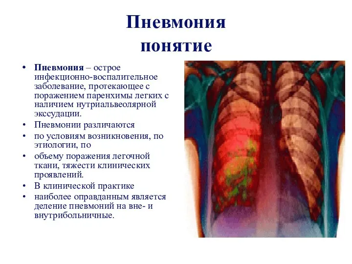 Пневмония понятие Пневмония – острое инфекционно-воспалительное заболевание, протекающее с поражением паренхимы