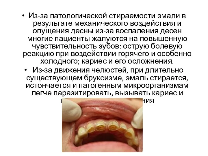 Из-за патологической стираемости эмали в результате механического воздействия и опущения десны