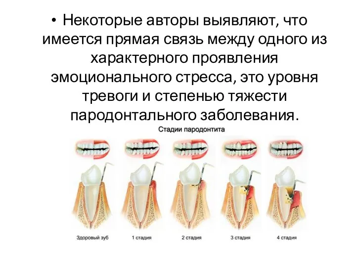 Некоторые авторы выявляют, что имеется прямая связь между одного из характерного