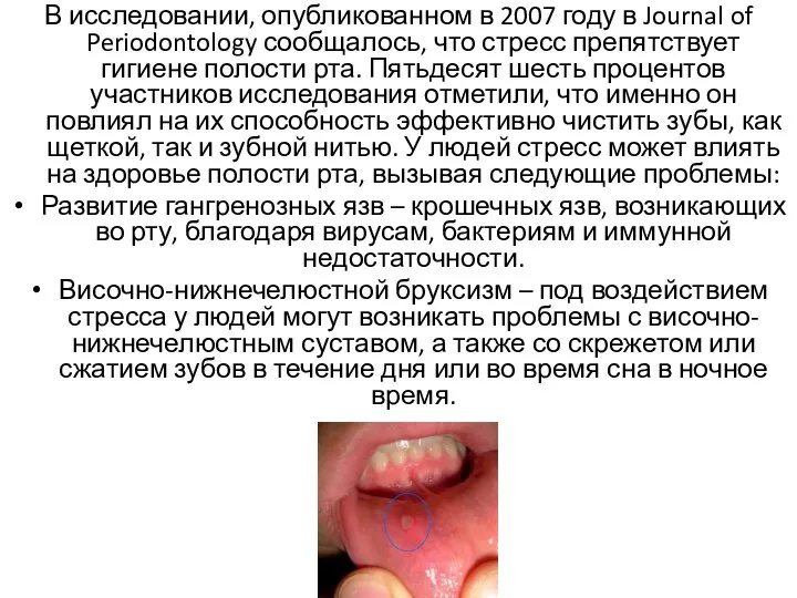 В исследовании, опубликованном в 2007 году в Journal of Periodontology сообщалось,