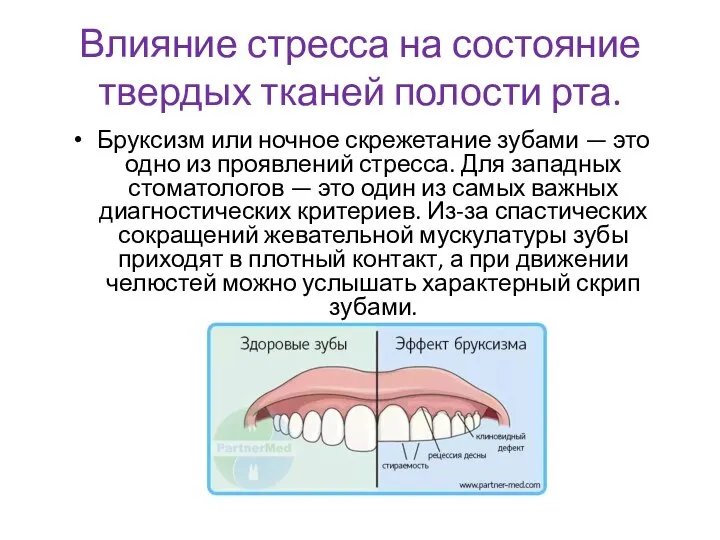 Влияние стресса на состояние твердых тканей полости рта. Бруксизм или ночное