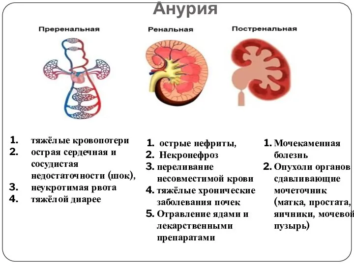 Анурия тяжёлые кровопотери острая сердечная и сосудистая недостаточности (шок), неукротимая рвота