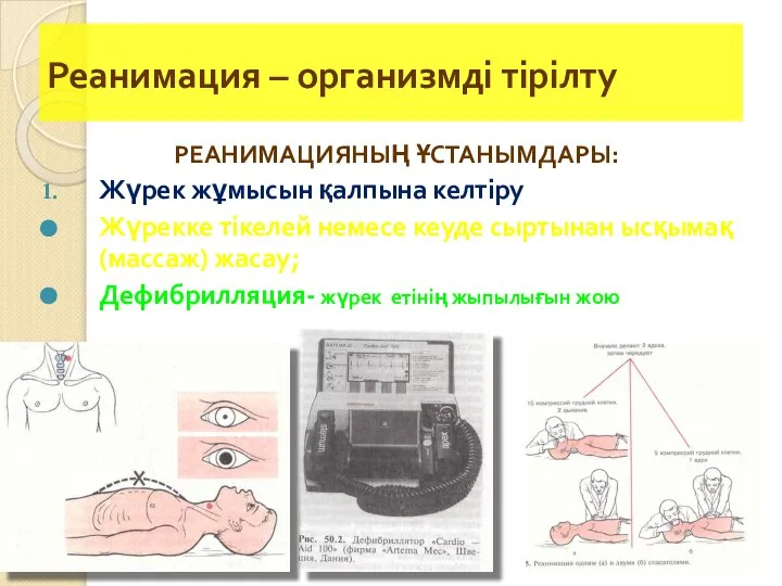 Реанимация – организмді тірілту РЕАНИМАЦИЯНЫҢ ҰСТАНЫМДАРЫ: Жүрек жұмысын қалпына келтіру Жүрекке