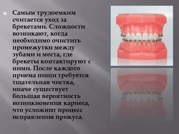 Самым трудоемким считается уход за брекетами. Сложности возникают, когда необходимо очистить