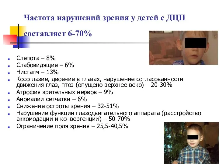 Частота нарушений зрения у детей с ДЦП составляет 6-70% Слепота –