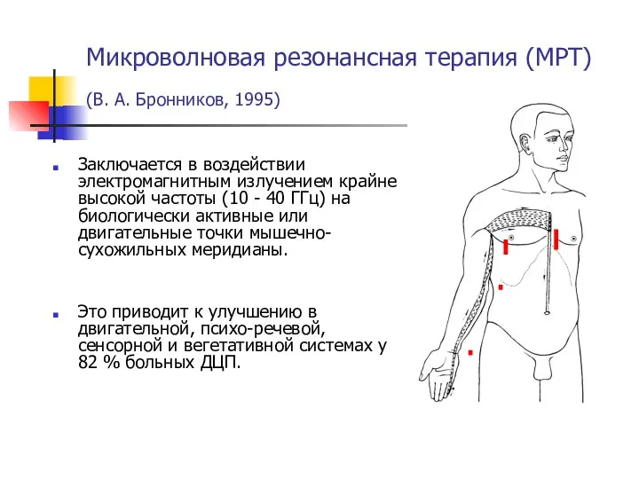 Микроволновая резонансная терапия (МРТ) (В. А. Бронников, 1995) Заключается в воздействии