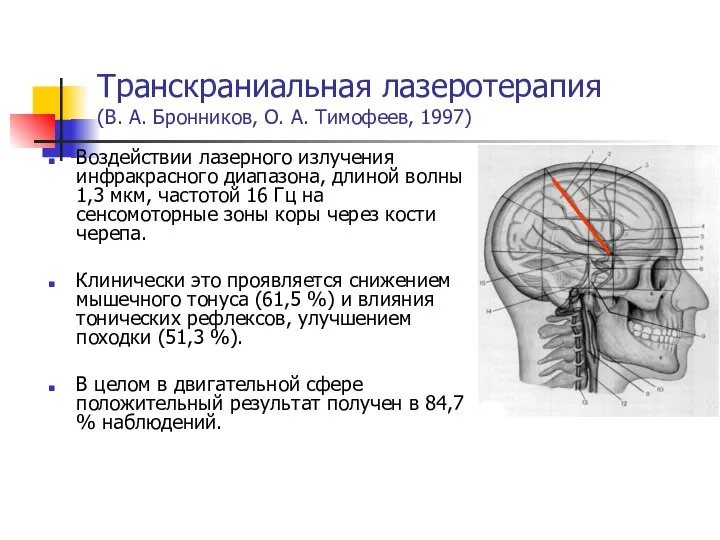 Транскраниальная лазеротерапия (В. А. Бронников, О. А. Тимофеев, 1997) Воздействии лазерного