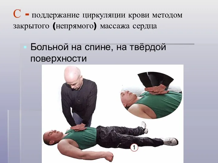 С - поддержание циркуляции крови методом закрытого (непрямого) массажа сердца Больной на спине, на твёрдой поверхности