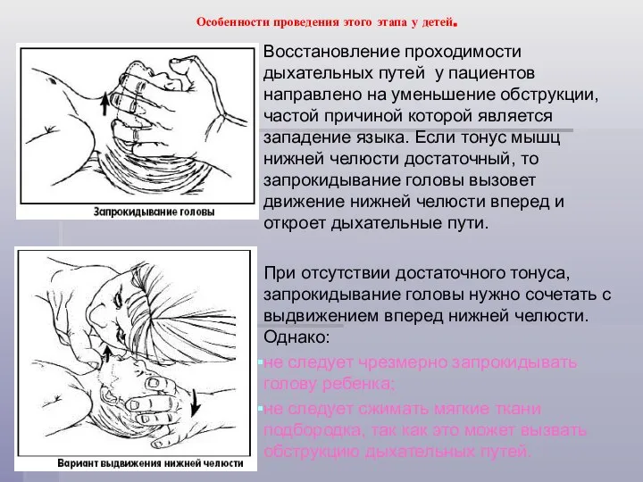 Особенности проведения этого этапа у детей. Восстановление проходимости дыхательных путей у