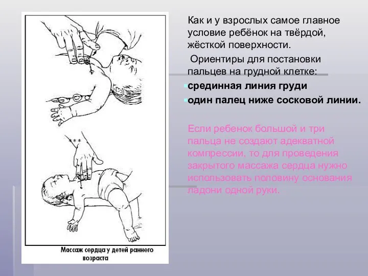 Как и у взрослых самое главное условие ребёнок на твёрдой, жёсткой