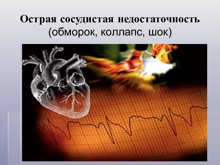 Острая сосудистая недостаточность (обморок, коллапс, шок)