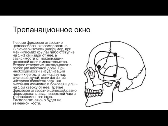 Трепанационное окно Первое фрезевое отверстие целесообразно формировать в «ключевой точке» (например,