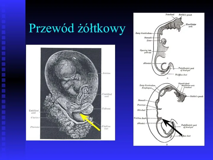 Przewód żółtkowy