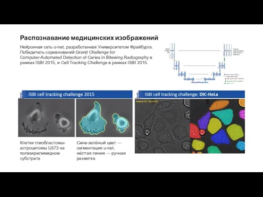 Распознавание медицинских изображений Клетки глиобластомы-астроцитомы U373 на полиакрилимидном субстрате Сине-зелёный цвет