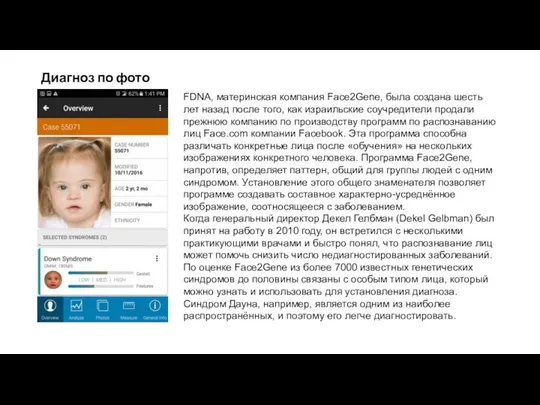 Диагноз по фото FDNA, материнская компания Face2Gene, была создана шесть лет