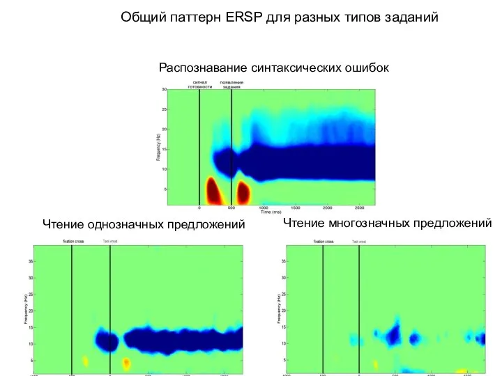 Чтение однозначных предложений Чтение многозначных предложений Распознавание синтаксических ошибок Общий паттерн ERSP для разных типов заданий