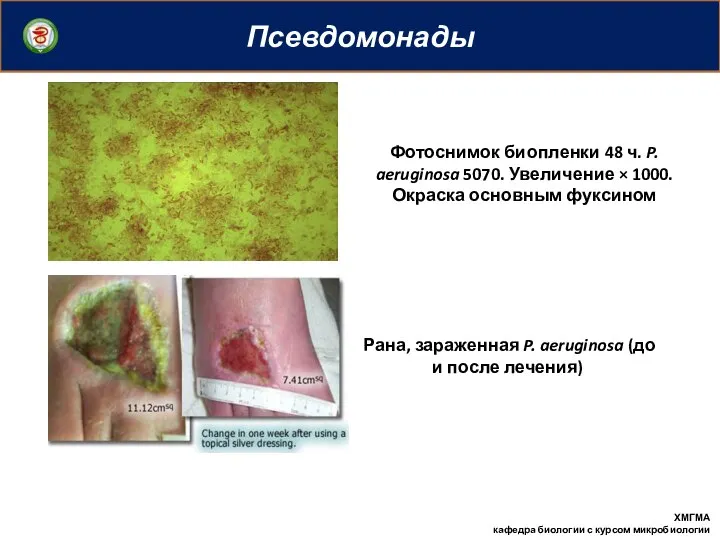 Псевдомонады ХМГМА кафедра биологии с курсом микробиологии Фотоснимок биопленки 48 ч.