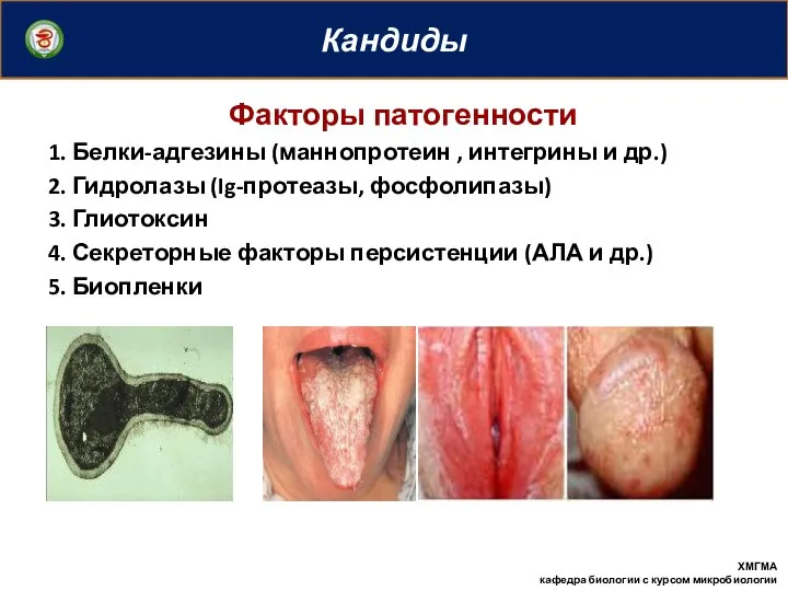 Кандиды ХМГМА кафедра биологии с курсом микробиологии Факторы патогенности 1. Белки-адгезины