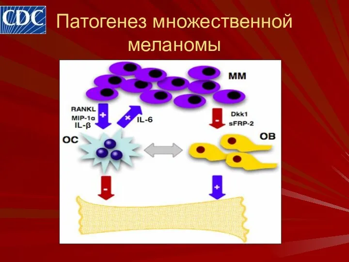 Патогенез множественной меланомы