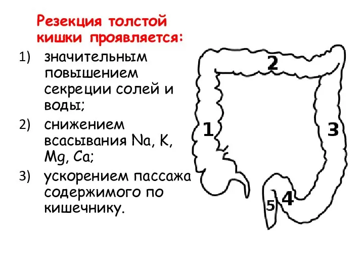 Резекция толстой кишки проявляется: значительным повышением секреции солей и воды; снижением