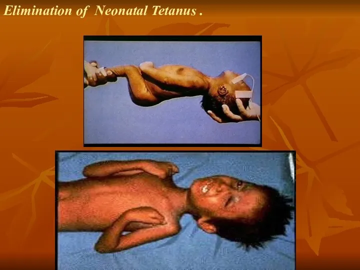 Elimination of Neonatal Tetanus .