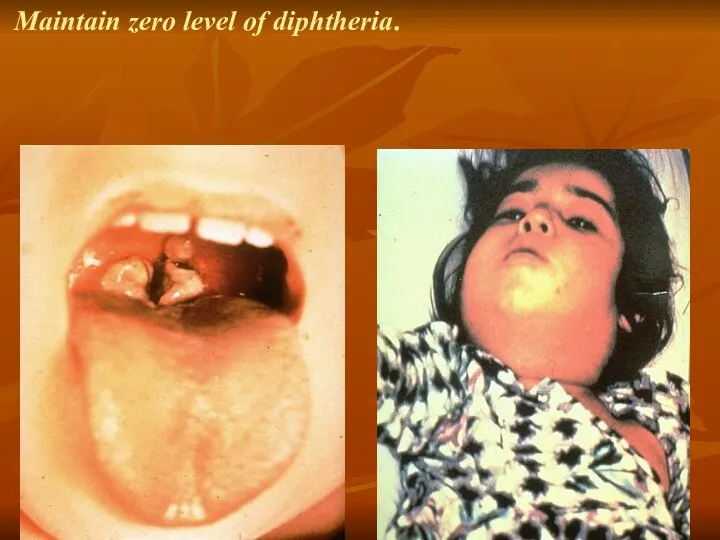 Maintain zero level of diphtheria.