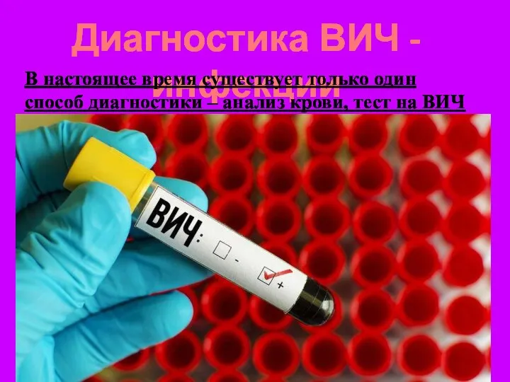 Диагностика ВИЧ -инфекции В настоящее время существует только один способ диагностики