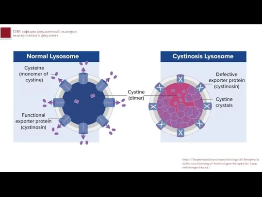 https://bioprocessintl.com/manufacturing/cell-therapies/scalable-manufacturing-of-lentiviral-gene-therapies-for-lysosomal-storage-diseases/