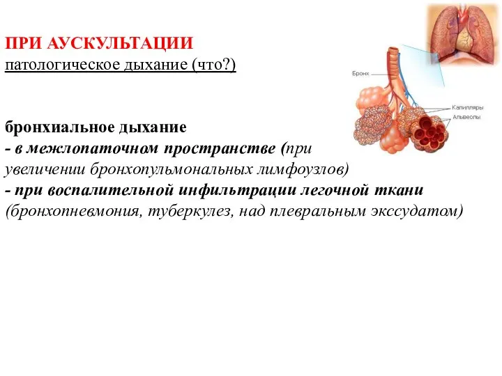 ПРИ АУСКУЛЬТАЦИИ патологическое дыхание (что?) бронхиальное дыхание - в межлопаточном пространстве