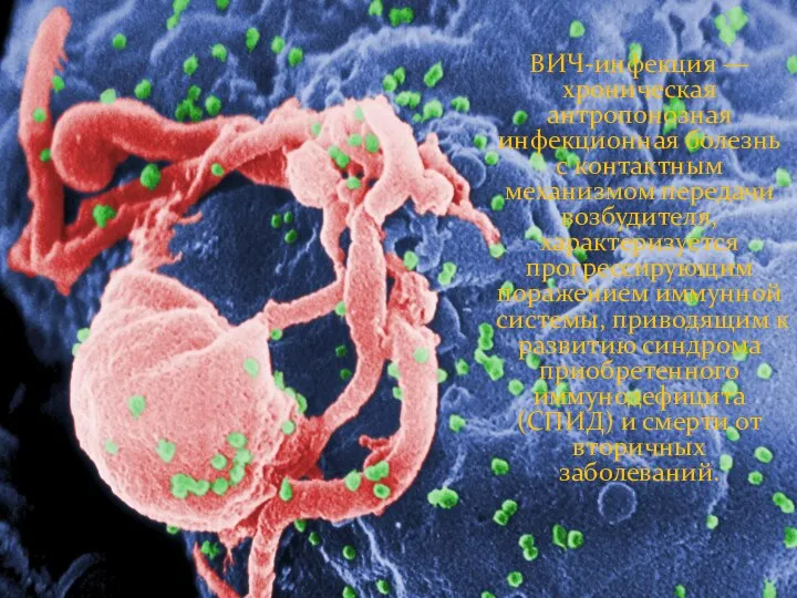 ВИЧ-инфекция — хроническая антропонозная инфекционная болезнь с контактным механизмом передачи возбудителя,