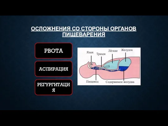 ОСЛОЖНЕНИЯ СО СТОРОНЫ ОРГАНОВ ПИЩЕВАРЕНИЯ РВОТА РЕГУРГИТАЦИЯ АСПИРАЦИЯ