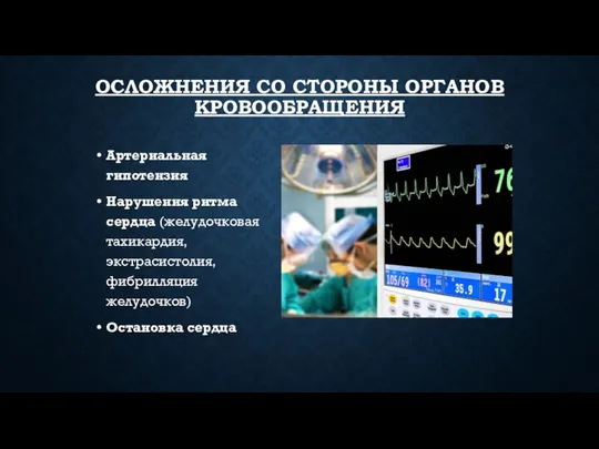 ОСЛОЖНЕНИЯ СО СТОРОНЫ ОРГАНОВ КРОВООБРАЩЕНИЯ Артериальная гипотензия Нарушения ритма сердца (желудочковая