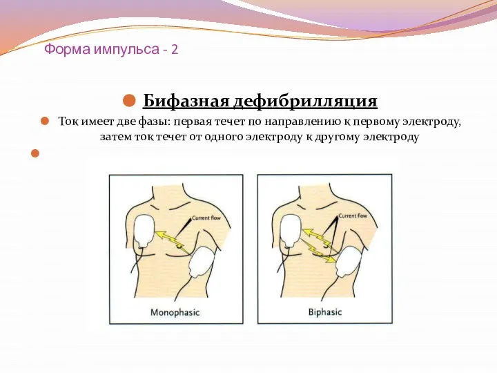 Форма импульса - 2 Бифазная дефибрилляция Ток имеет две фазы: первая