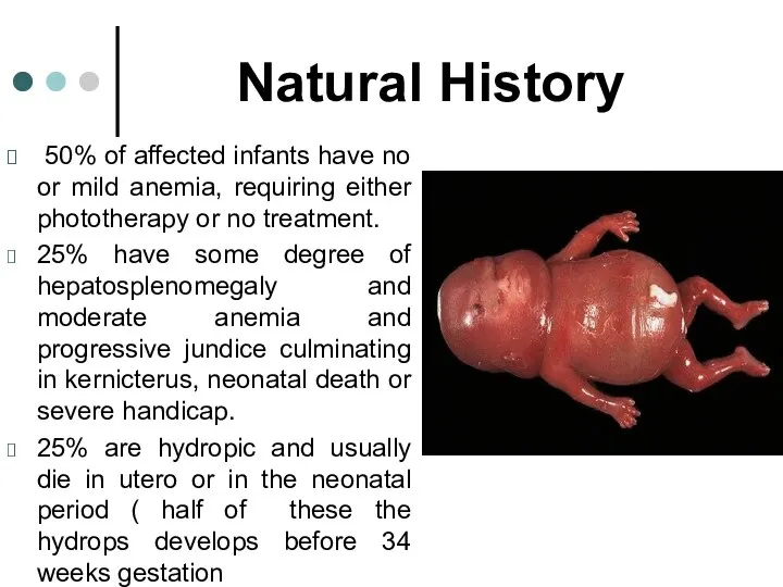 Natural History 50% of affected infants have no or mild anemia,